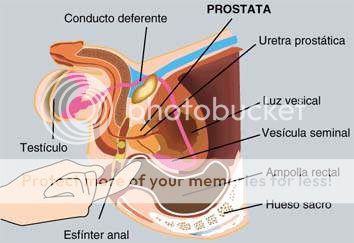 prostata.jpg