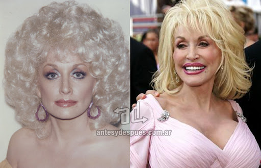 dolly_parton_antes_y_despues_cirugia.jpg