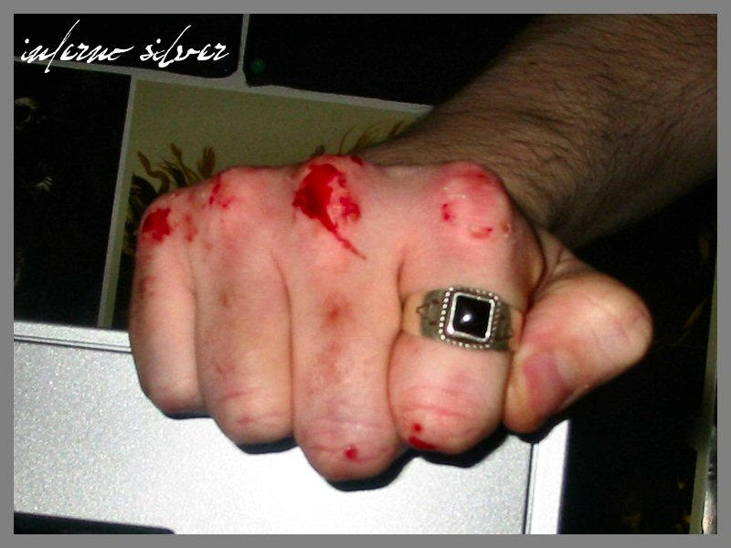 Fanged_Knuckles_Bloodied_Fist_by_infernosilver.jpg