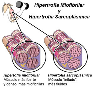 hipertrofias.jpg