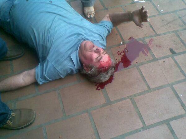 herido-ciudad-ojeda-por-opositores.jpg