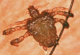ladilla1.jpg