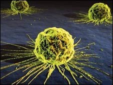 100216165815_cancermamaspl_226.jpg