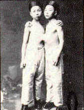 chang_eng-siamese_twins.jpg