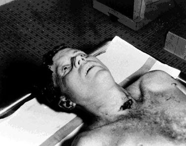 Asesinato%2Bde%2BKennedy%2B6.jpg