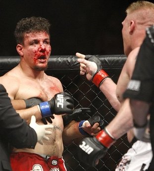 capt.b937663733814e05b45c652eb7deda51.mma_ufc_100_nvlas202.jpg