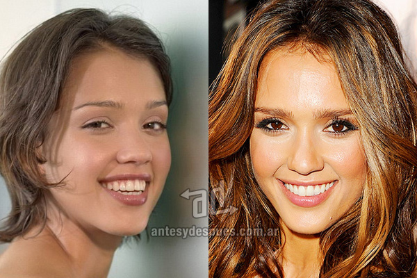 jessica-alba_dientes_antesydespues.com.ar.jpg