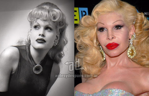 amanda_lepore_antes_y_despues_cirugia.jpg