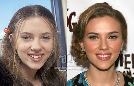 scarlett_johansson_antes_y_despues_cirugia.jpg