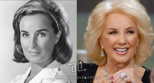 mirtha_legrand_antes_y_despues_cirugia.jpg