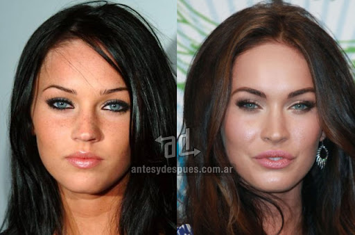 megan_fox_antes_y_despues_cirugia.jpg