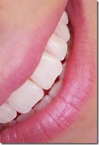 dientes%2Bblancos%5B4%5D.jpg