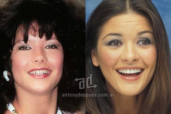 catherine-zeta-jones_dientes_antesydespues.com.ar.jpg