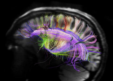El-cableado-neuronal-se-enreda-en-estructuras-cruzadas_image365_.jpg